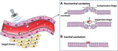 Ultrasound combined with microbubble mediated immunotherapy for tumor microenvironment